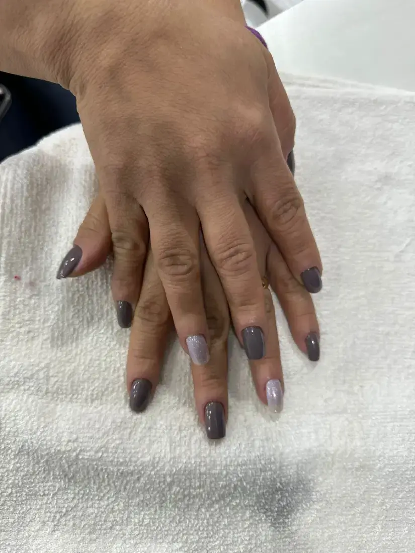 Unhas